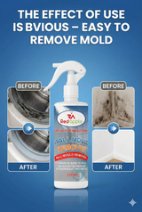 Powerful Oxalic Acid Surface Cleaner – Pack of 2 🧴 | Flat 50% OFF 🔥 Hurry, Limited Stock!